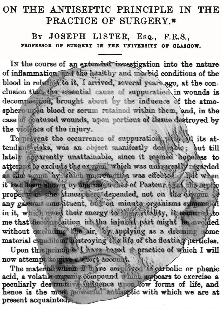 Joseph Lister | Portraits of European Neuroscientists